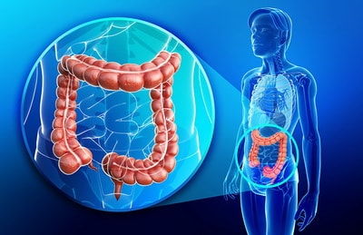 colon infection