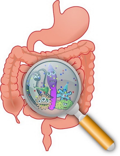 colon infection