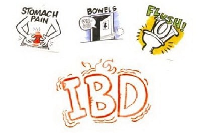 Inflammatory Bowel Disease