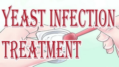 cure yeast infection